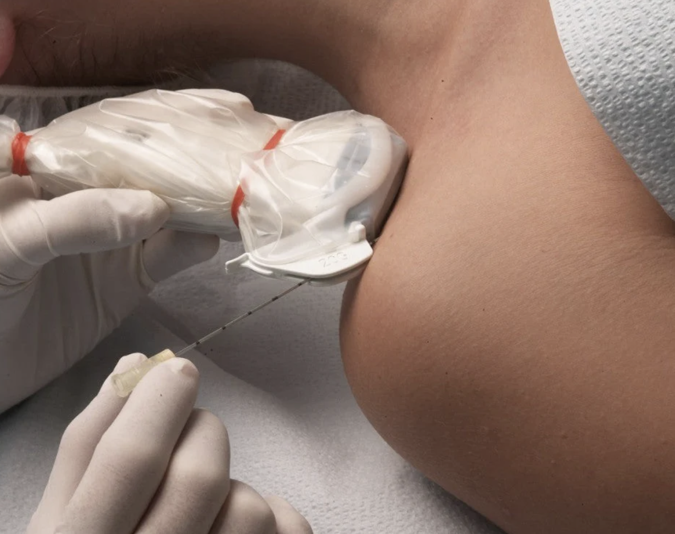 A portable ultrasound device labeled ‘echopen 01’ on a blue background, surrounded by medical tools including syringes, a stethoscope, a pen, and wooden tongue depressors.