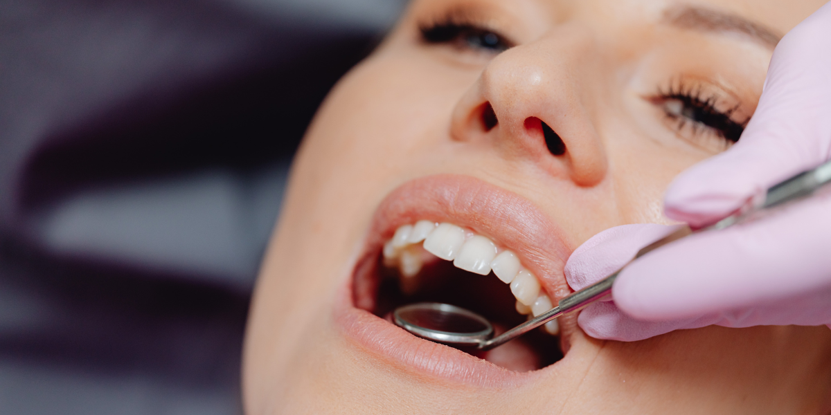 Woman undergoing a dental check-up with a dentist using a mouth mirror and dental tool at Busselton Dental Clinic