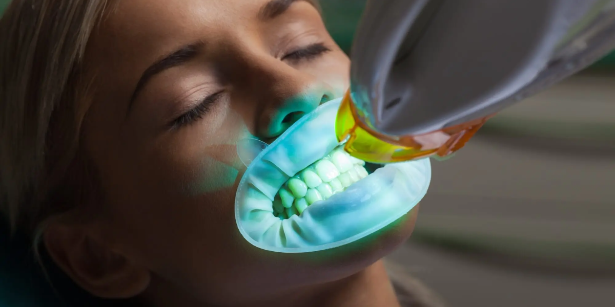 A woman undergoing professional teeth whitening with a blue light device at a dental clinic, showing how expert treatment creates a naturally bright smile without looking artificial.