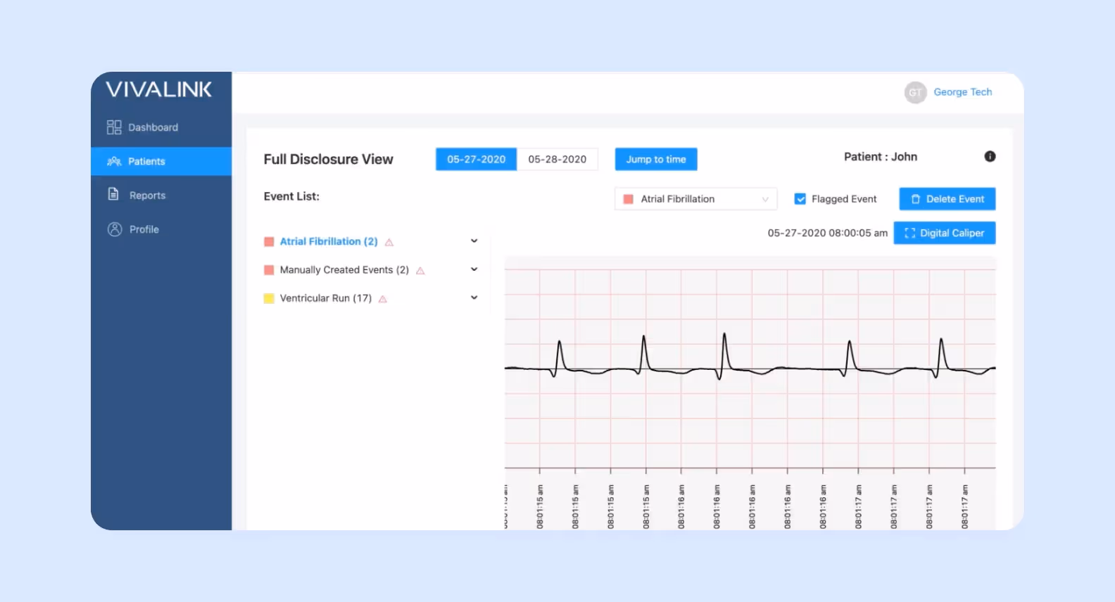 Wearable biometrics data platform screenshot