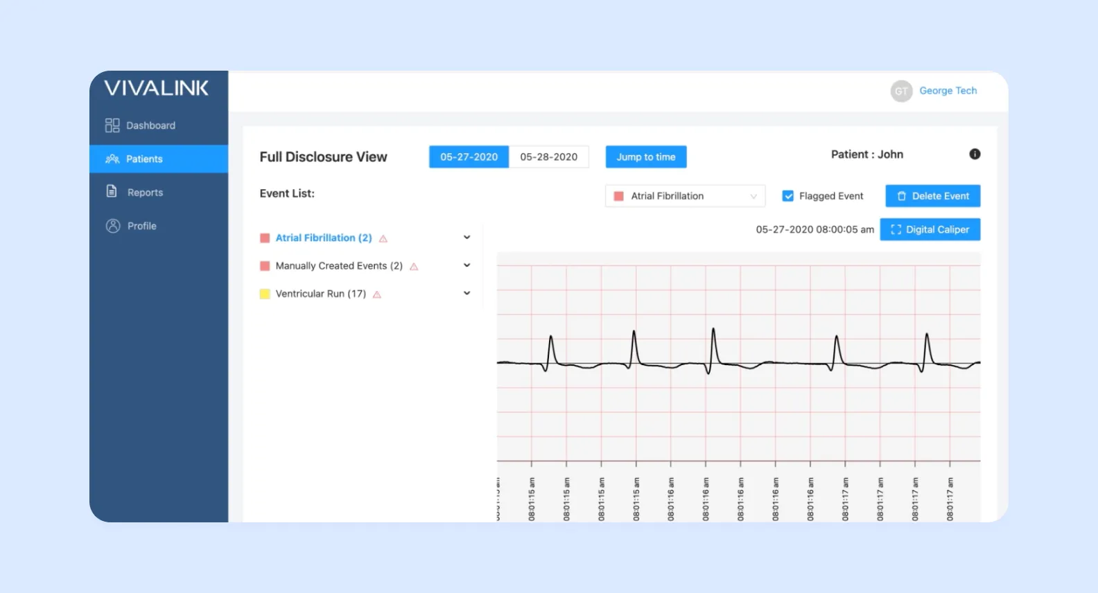 Wearable biometrics data platform screenshot