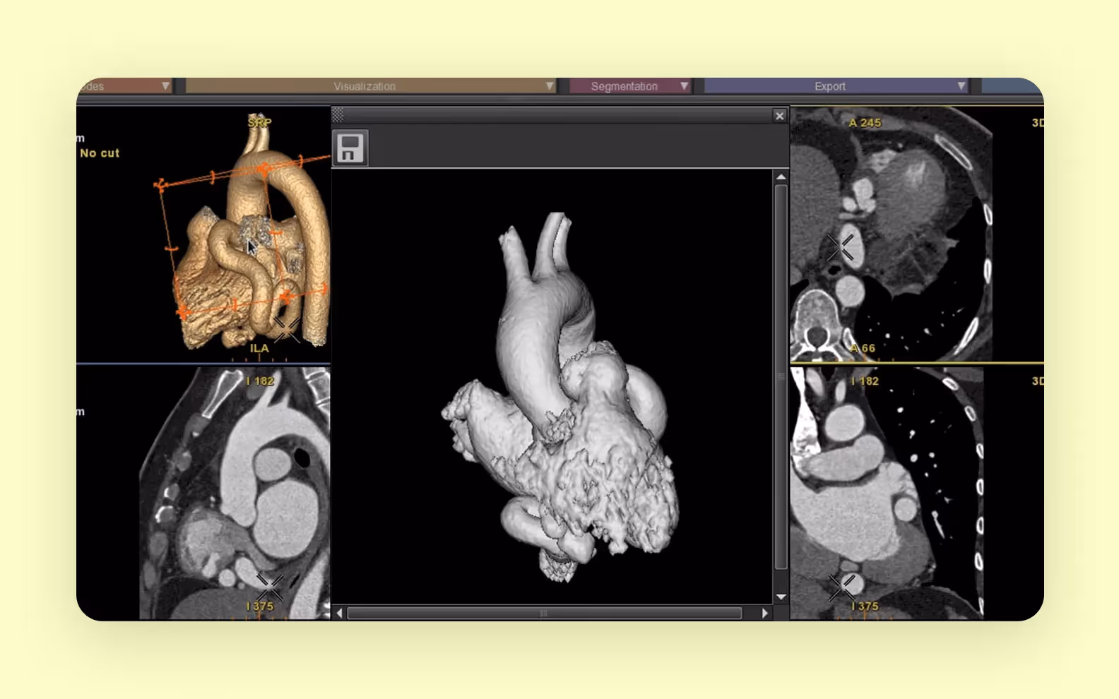 A software that can convert medical scans into printable 3D files