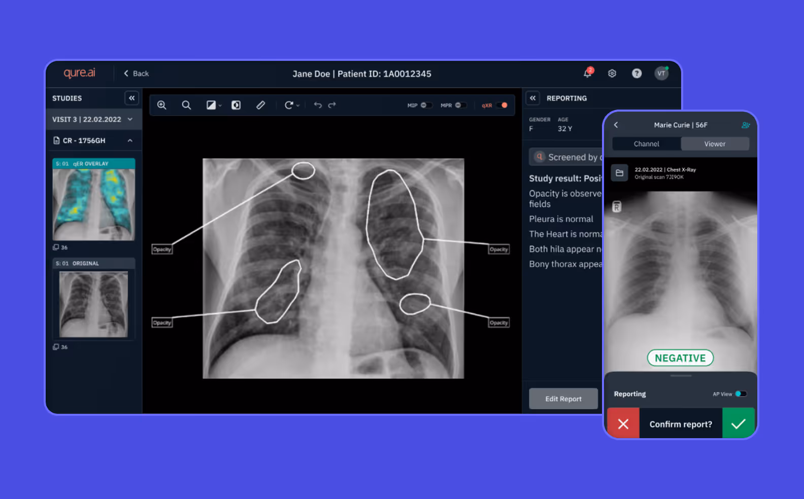 Экраны веб- и мобильного приложения для диагностики на основе ИИ