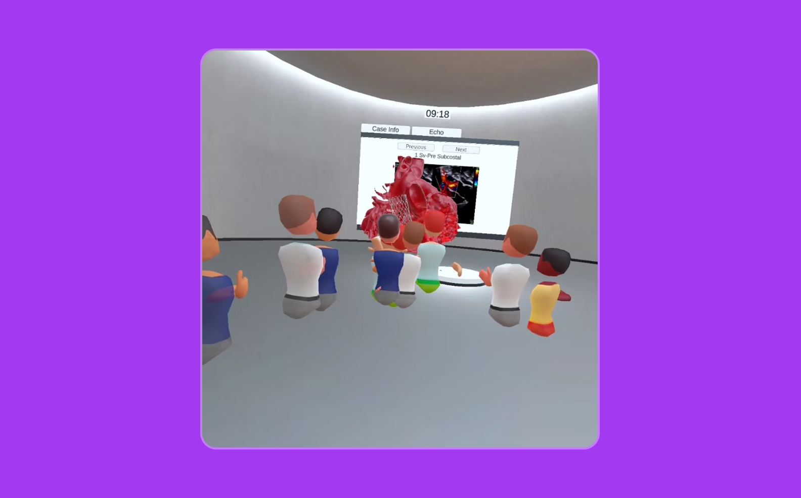 Vhearts snapshot of heart model