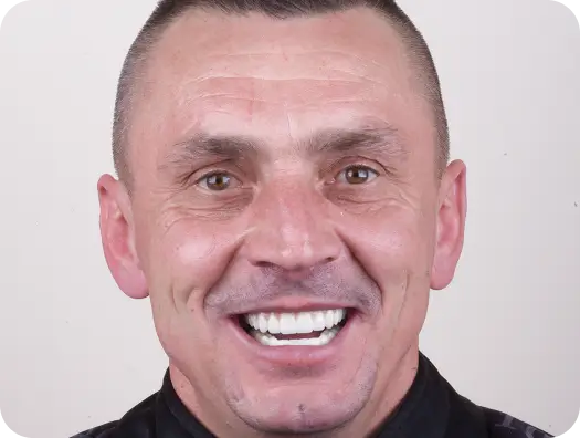 Pan Wojciech - po zabiegu