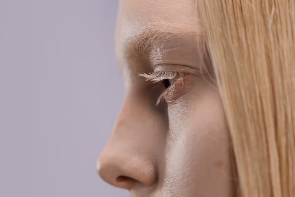 Male and female facial profile showing different ideal brow positions - lateral eyebrow lift