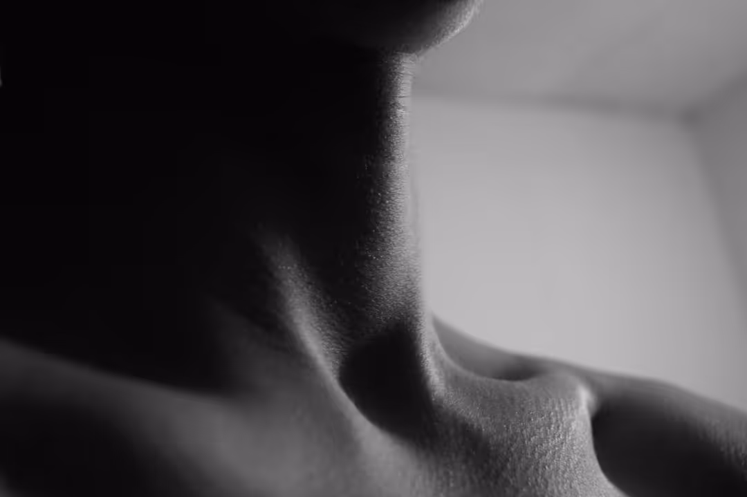 Overactive Thyroid