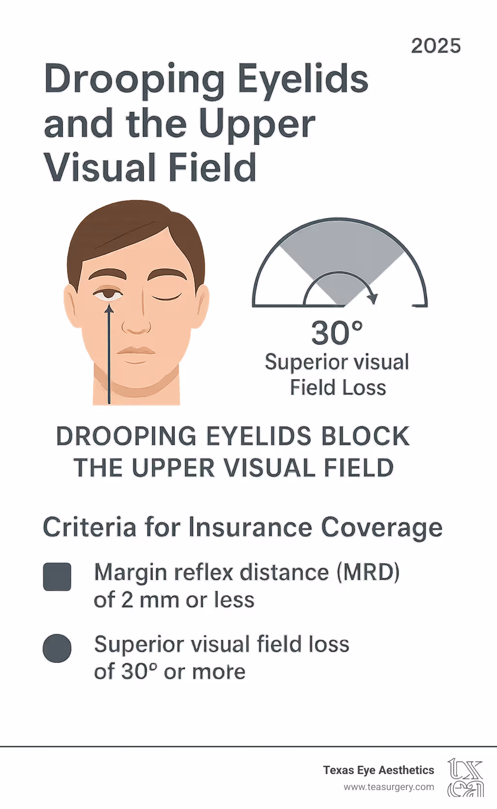 infographic showing how drooping eyelids block the upper visual field, with measurements of margin reflex distance and visual field degrees, plus criteria for insurance coverage including MRD of 2mm or less and superior visual field loss of 30 degrees or more - does insurance cover ptosis surgery infographic 