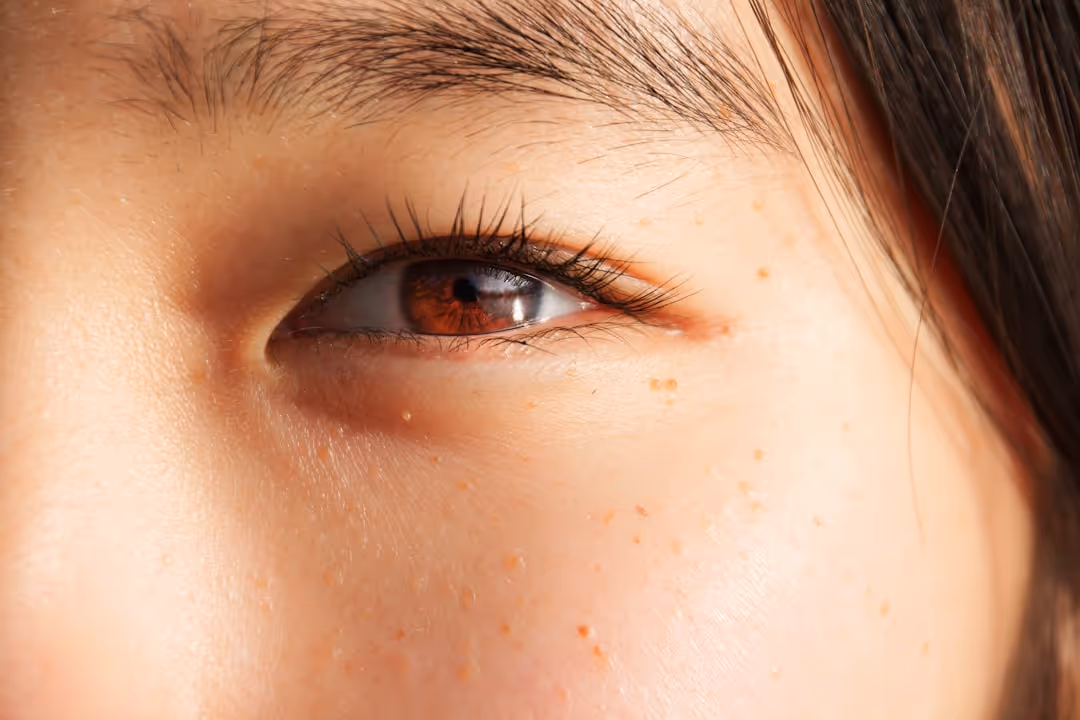 Bump Eyelid