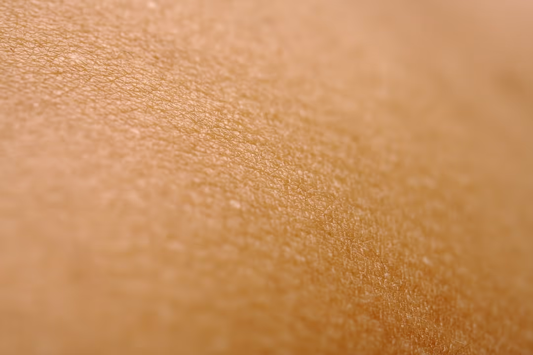Laser Skin Treatments