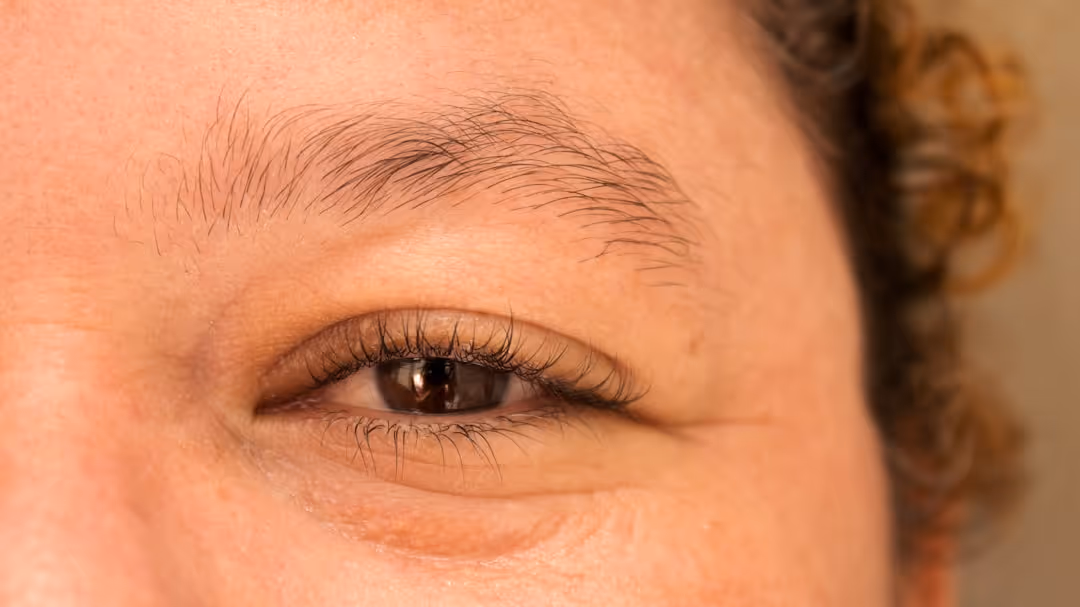 collage of common eyelid issues like redness, swelling, and a stye - eyelid problems