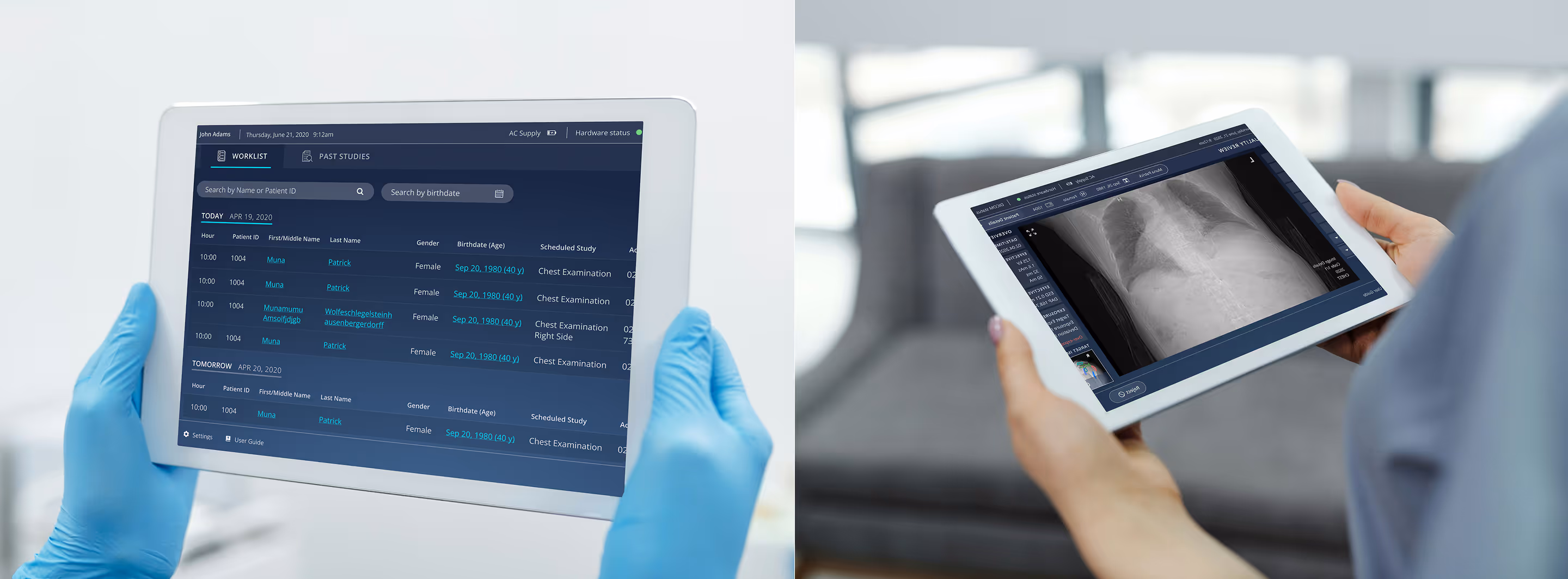 2 images side by side, on the left a person in medical blue gloves holding an iPad screen with the Pristem application, to the right a medical staff holding an iPad with a radiogrpahy image