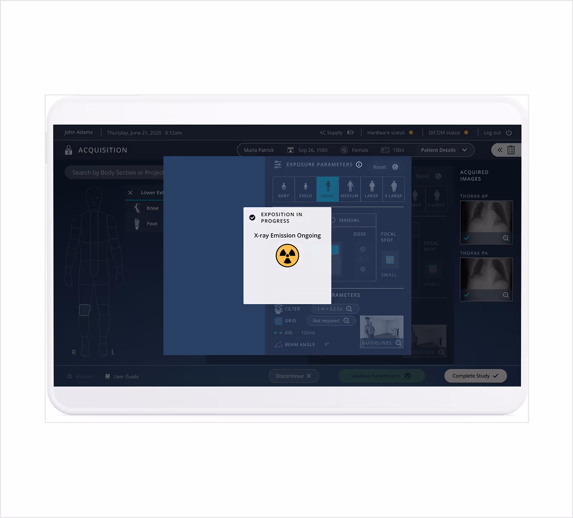 An iPad screen floating on a white background with the pristem application on the screen, showing a loading x-ray shot