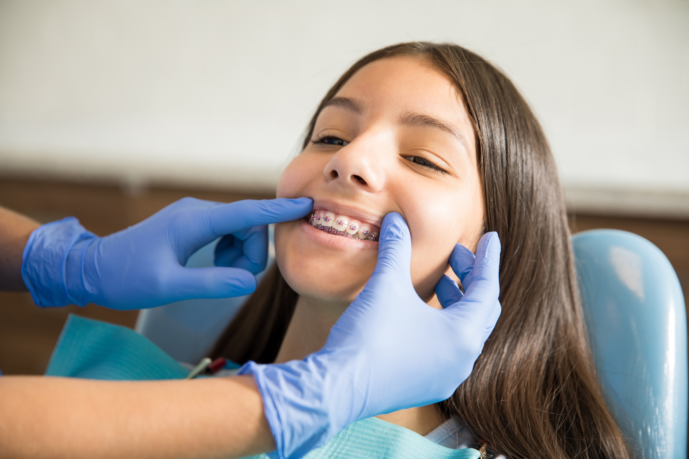 MSE (marpe) for Non-Surgical Expansion