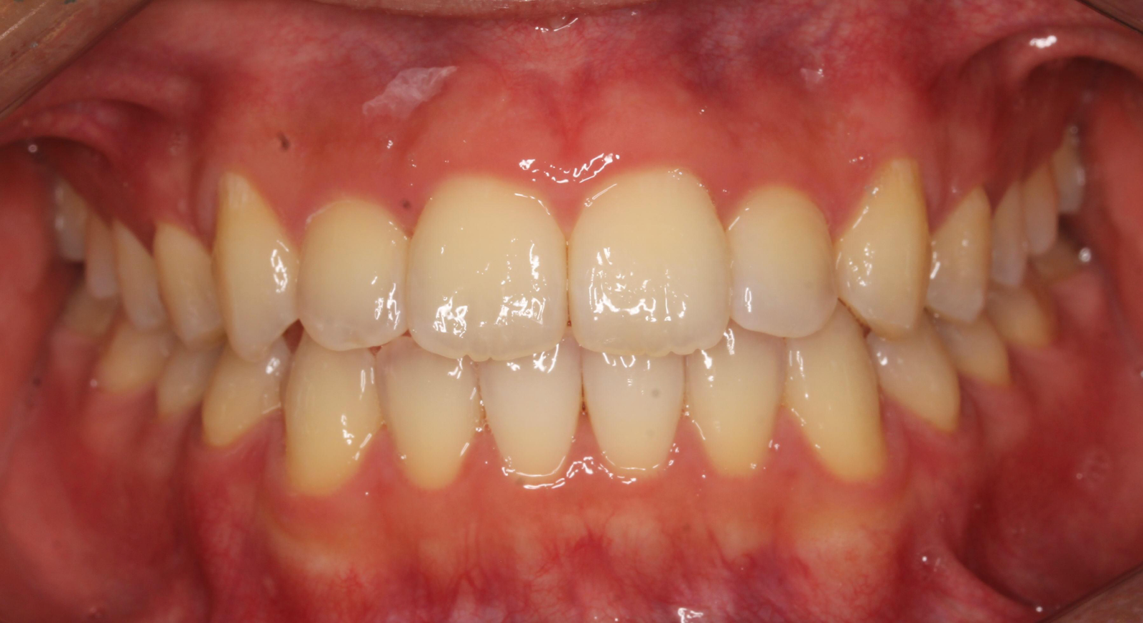 After Image