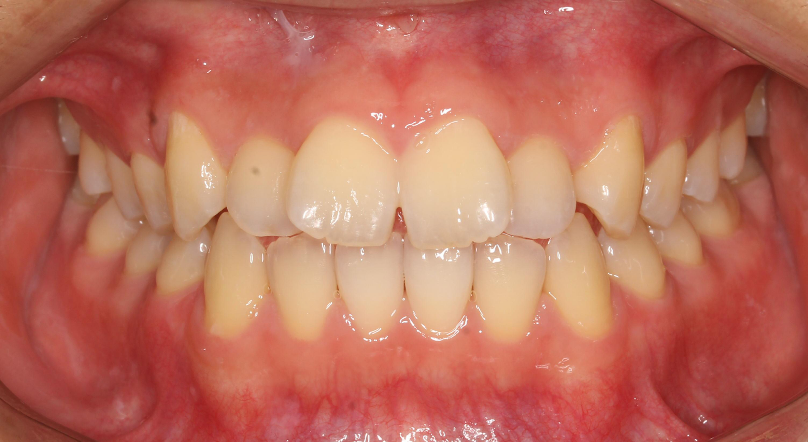 Before Image