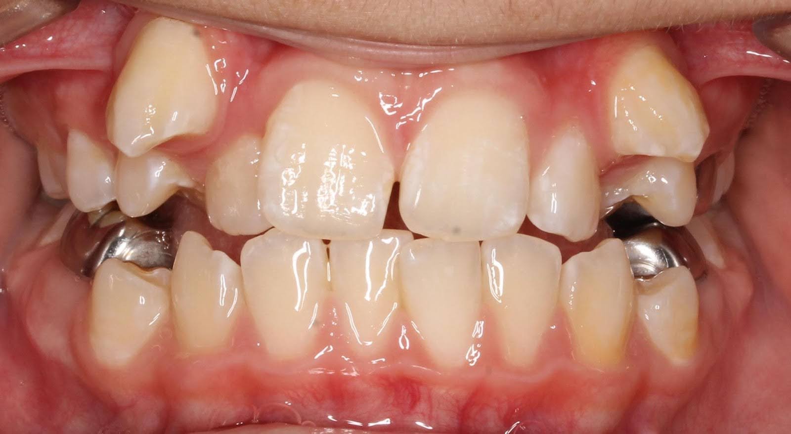 Before Image