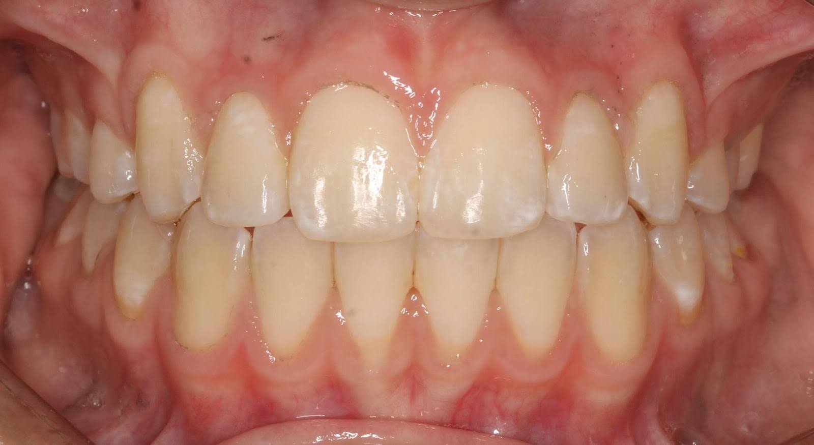 After Image