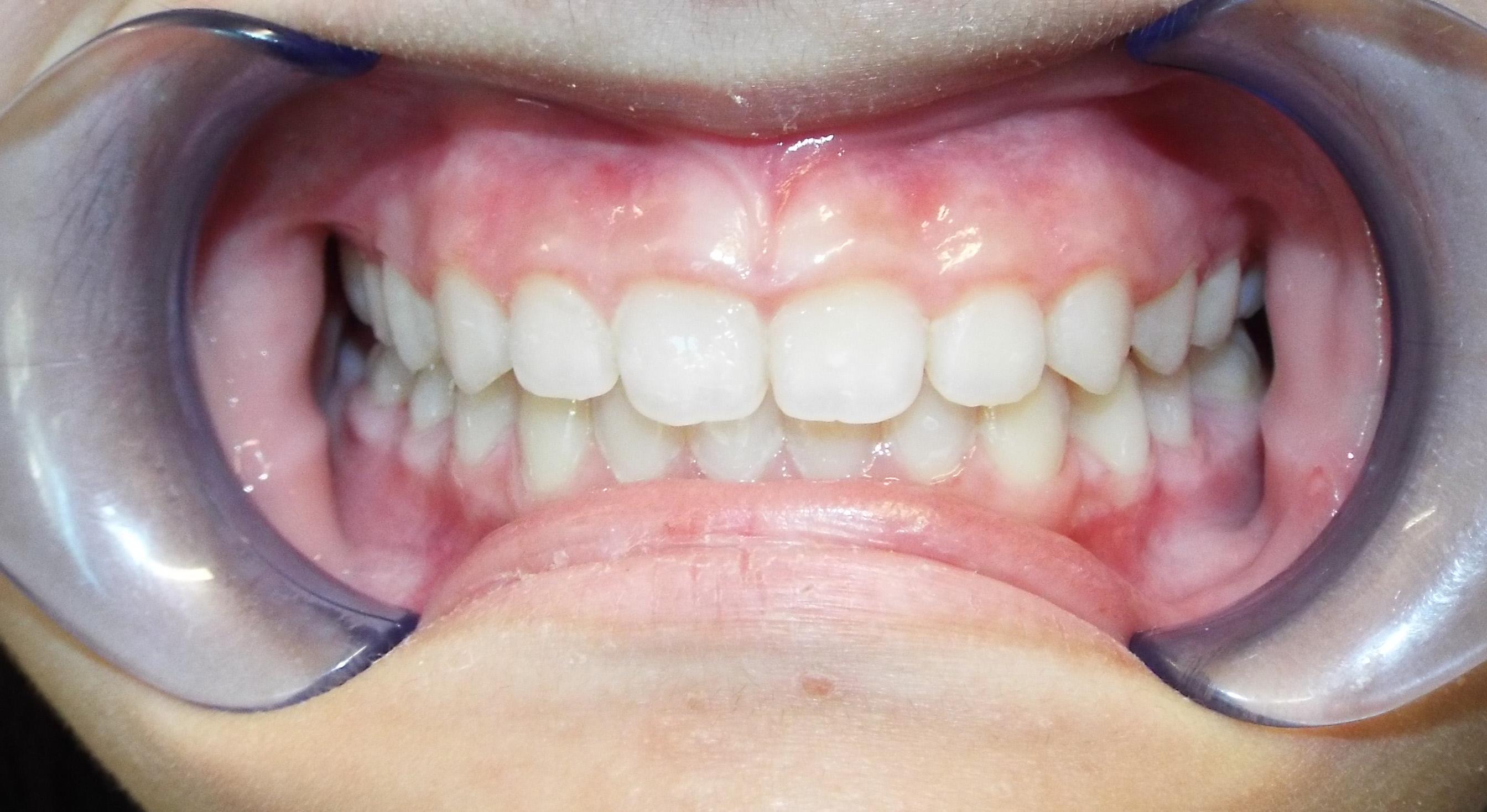 After Image