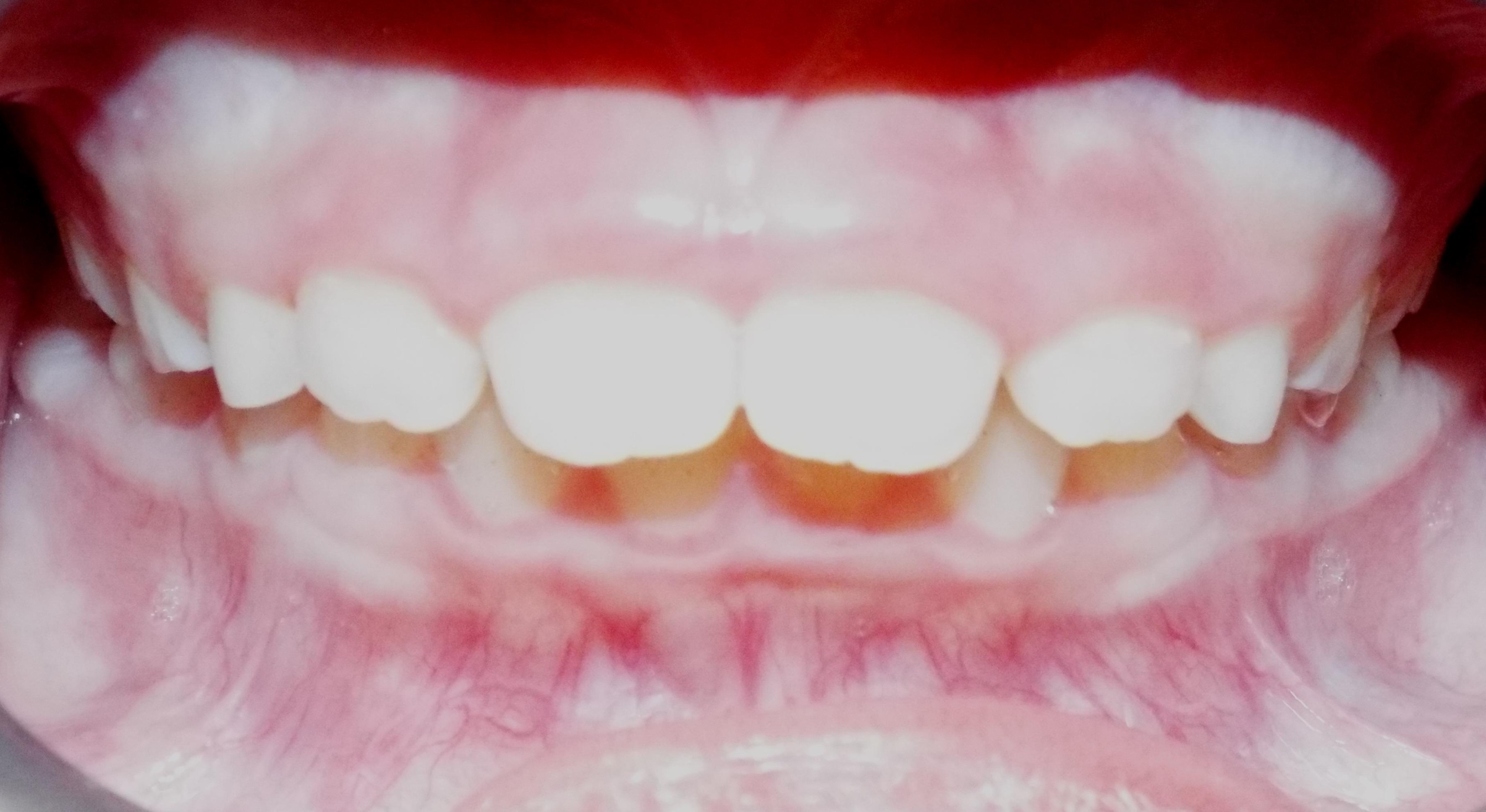 Before Image