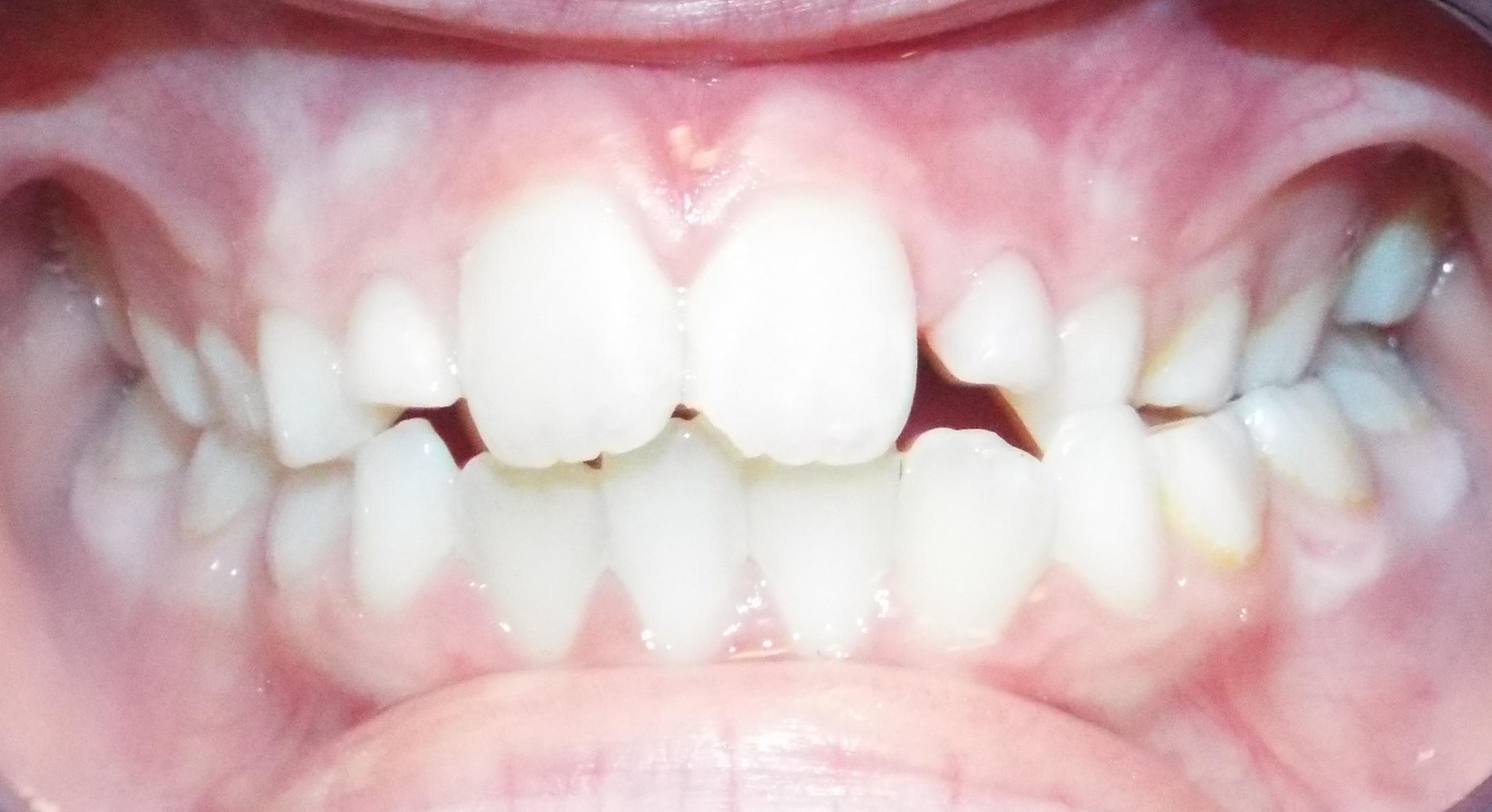 Before Image