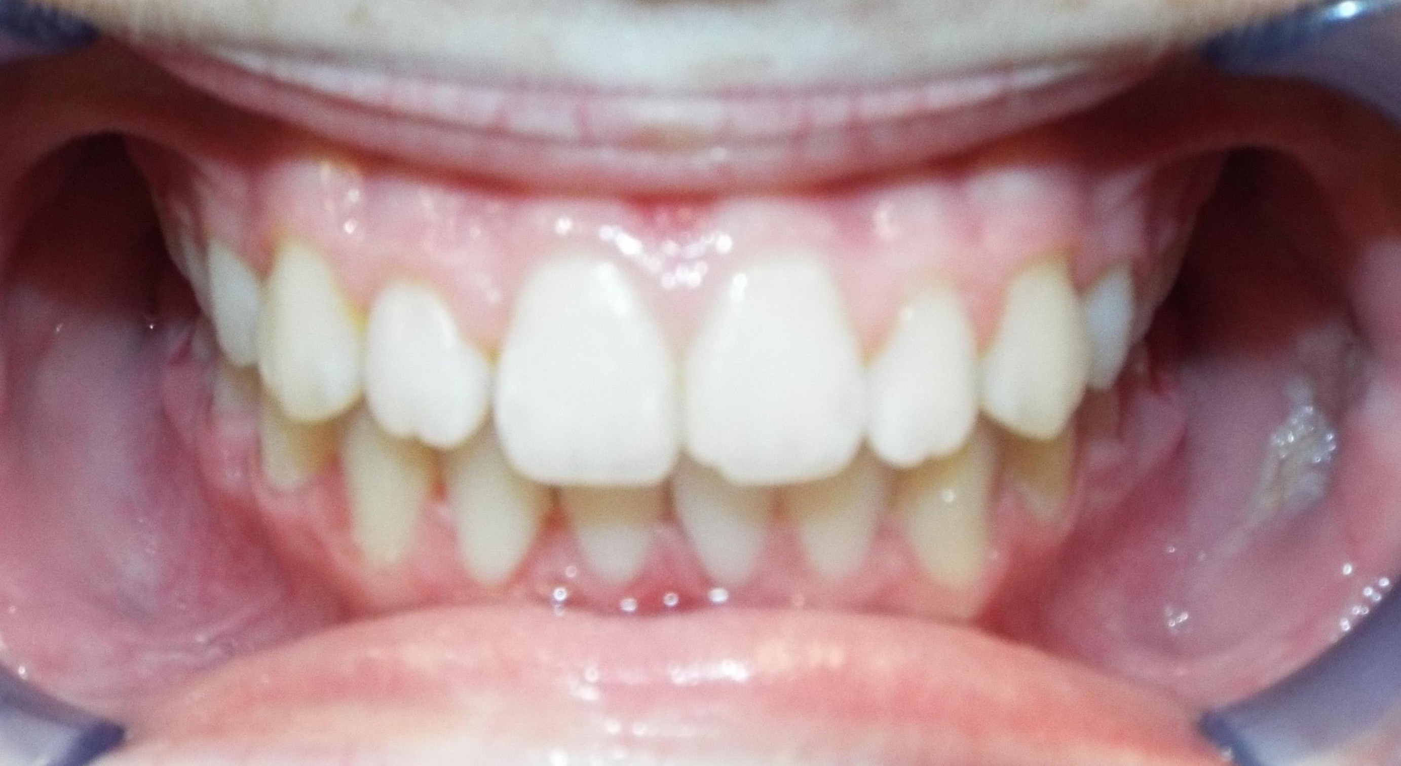 After Image