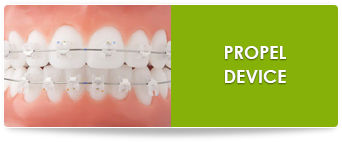 speed clear braces