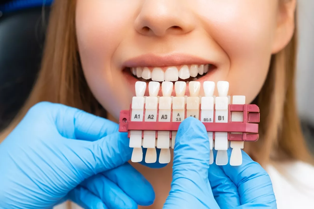 Dentist checking tooth colour shade during a teeth whitening consultation in Malvern