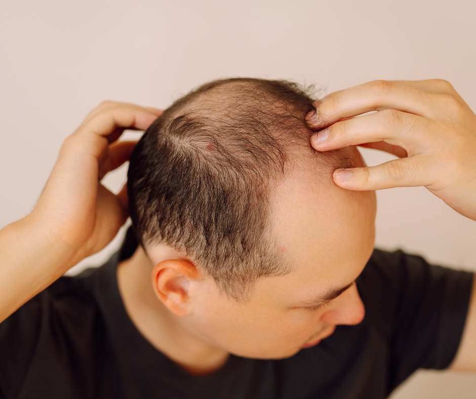 hair growth treatment tampa fl