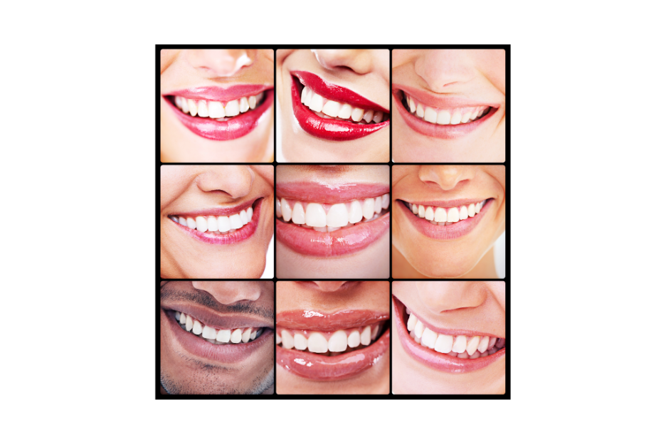 Grid of nine close-up smiles showing different lips, skin tones, and tooth shapes, illustrating the range of natural-looking smile aesthetics in cosmetic dentistry.