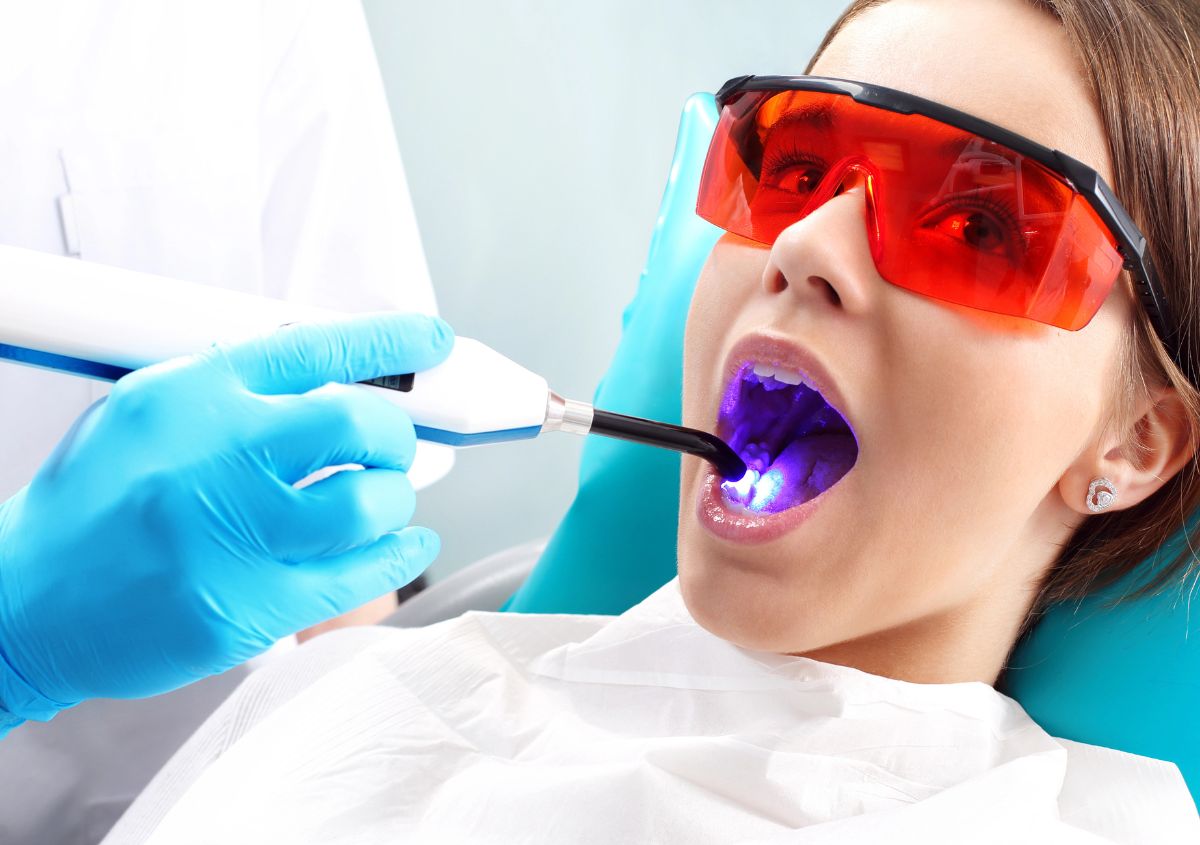 Gum lift improving smile balance and creating a natural look