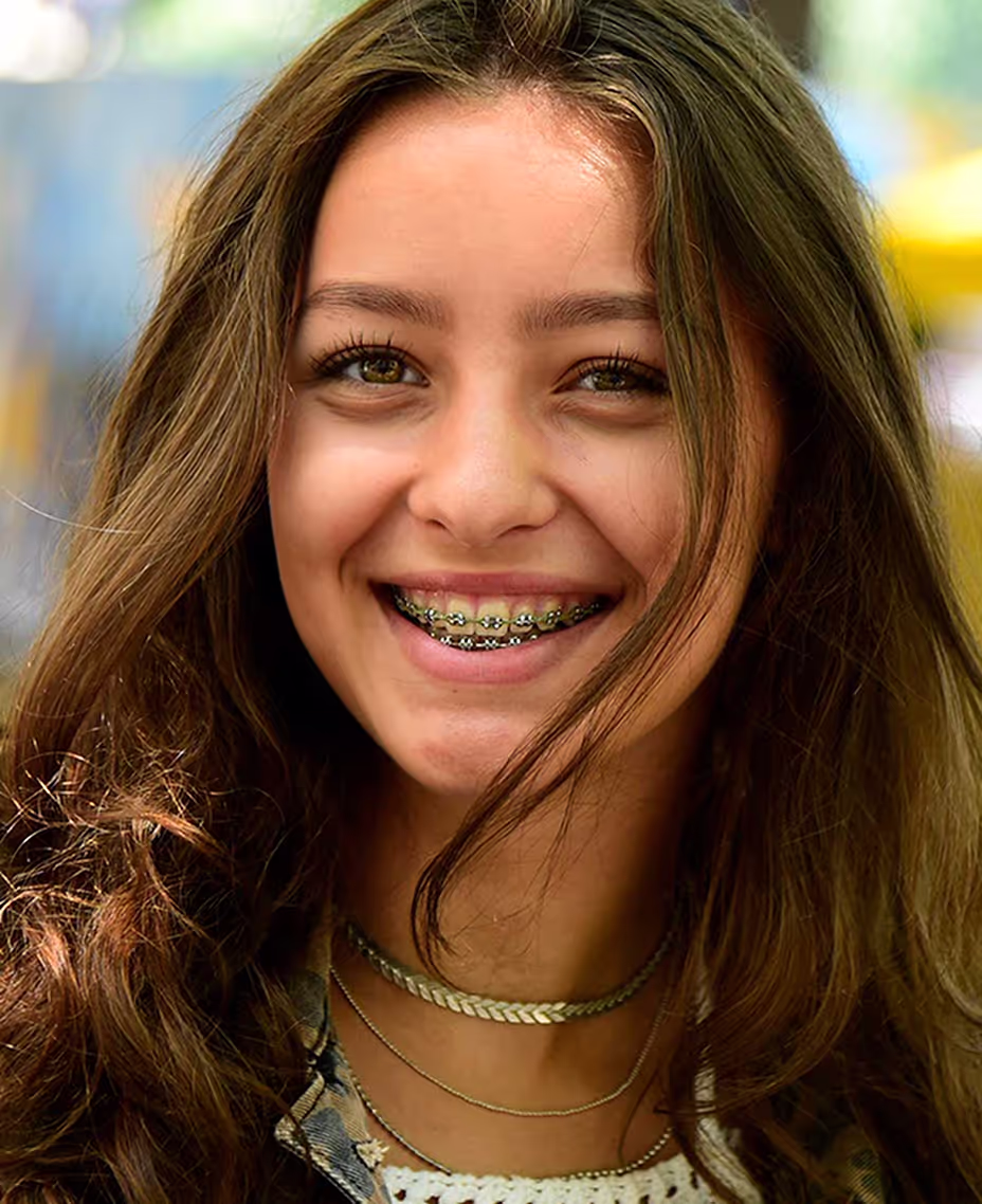 Braces in Dubai | Orthodontist at JLT MedDental Clinic