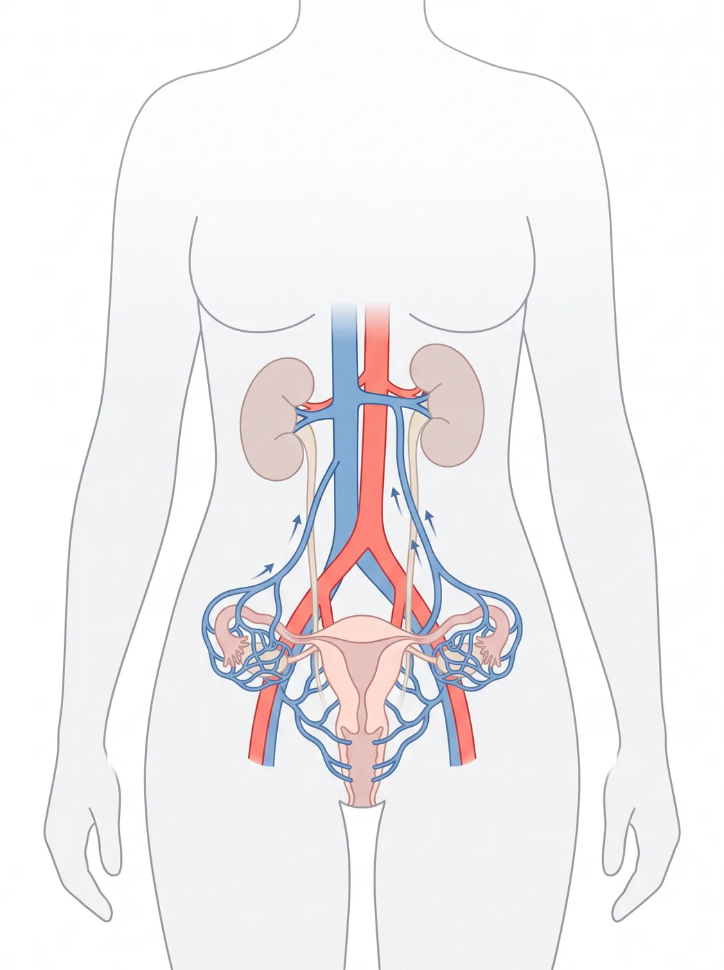 Anatomie normale des veines du pelvis : le drainage veineux s'effectue vers le haut, vers le cœur, et les veines ne sont pas dilatées.