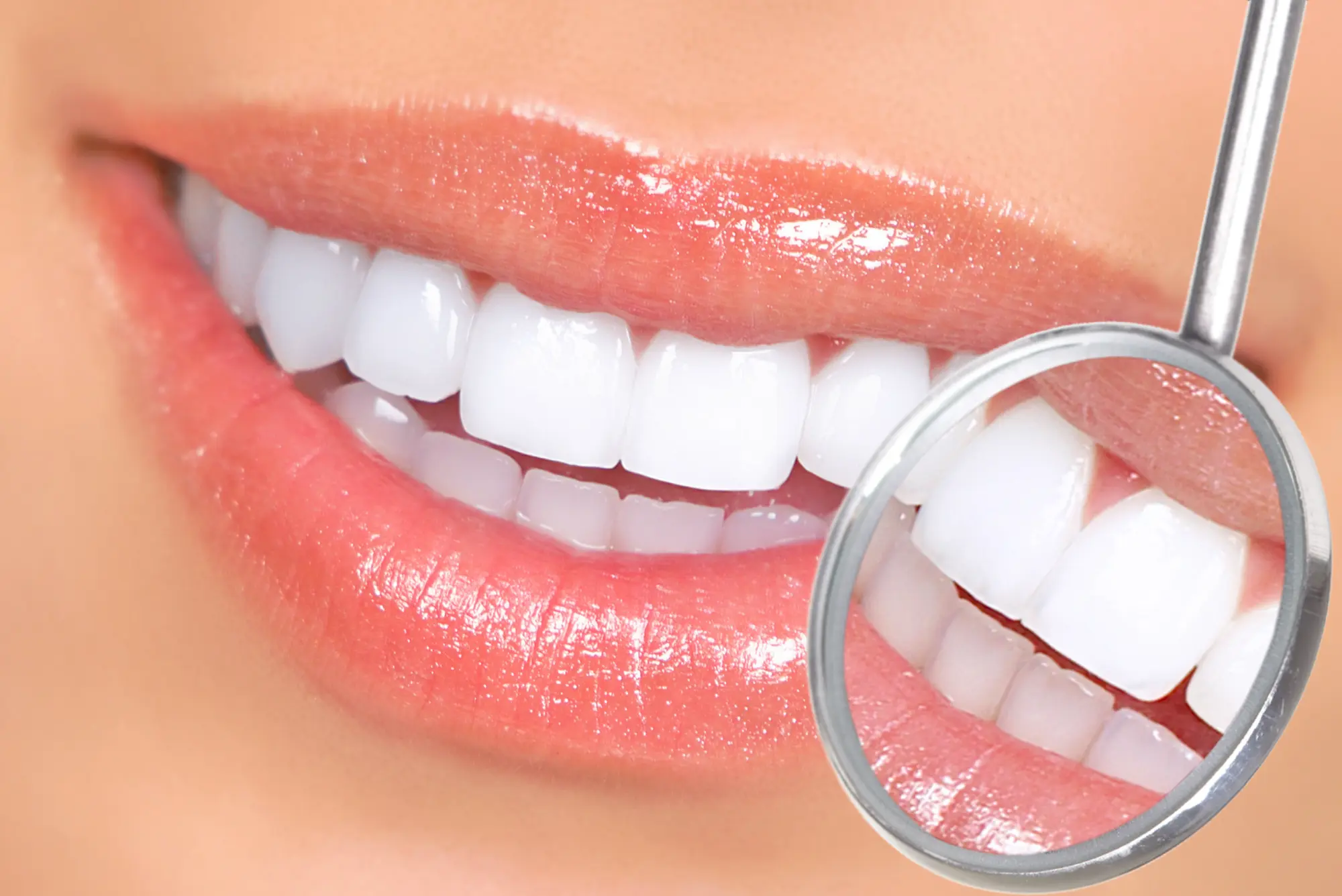 Teeth Whitening on the SF Peninsula in San Mateo | Manyak Dental Group