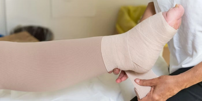 Terapia compressiva per linfedema o lipedema