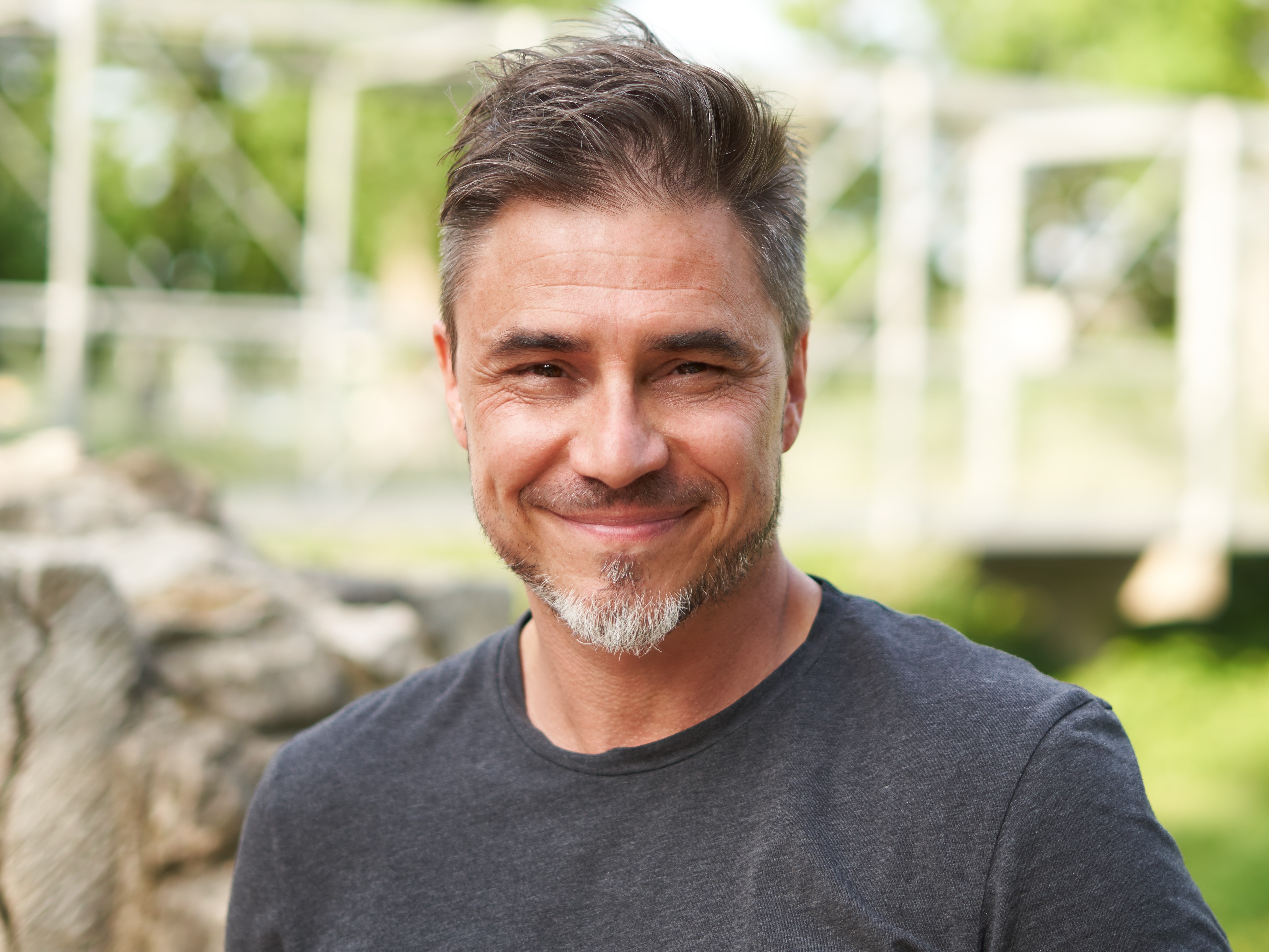 Fuller, thicker hair after Alma TED hair restoration