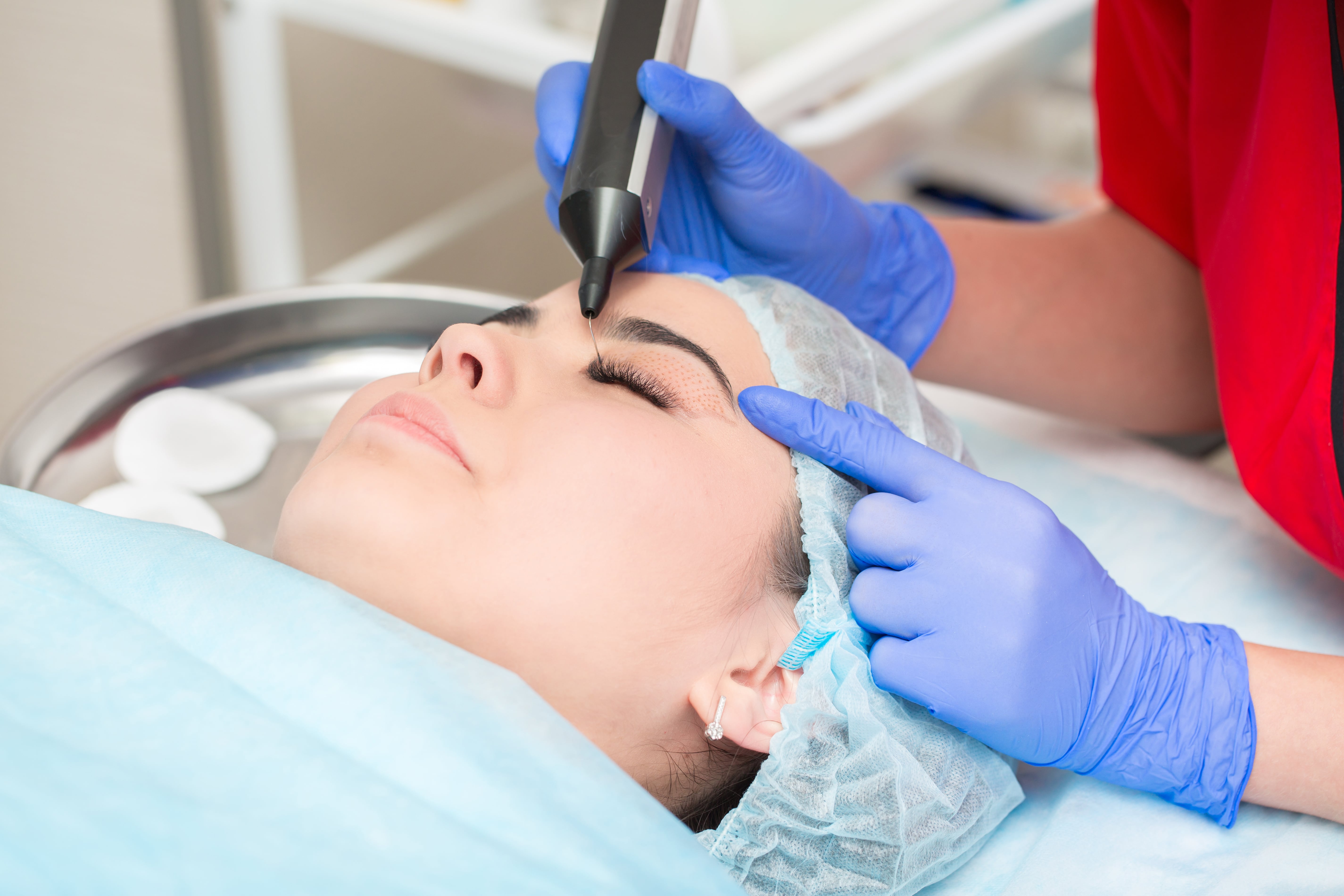 Alma IQ skin analysis at Carolina Trim Clinic
