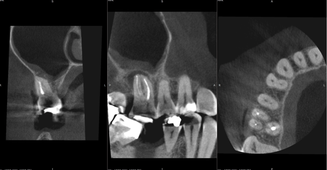 A close-up of a dental x-rayDescription automatically generated