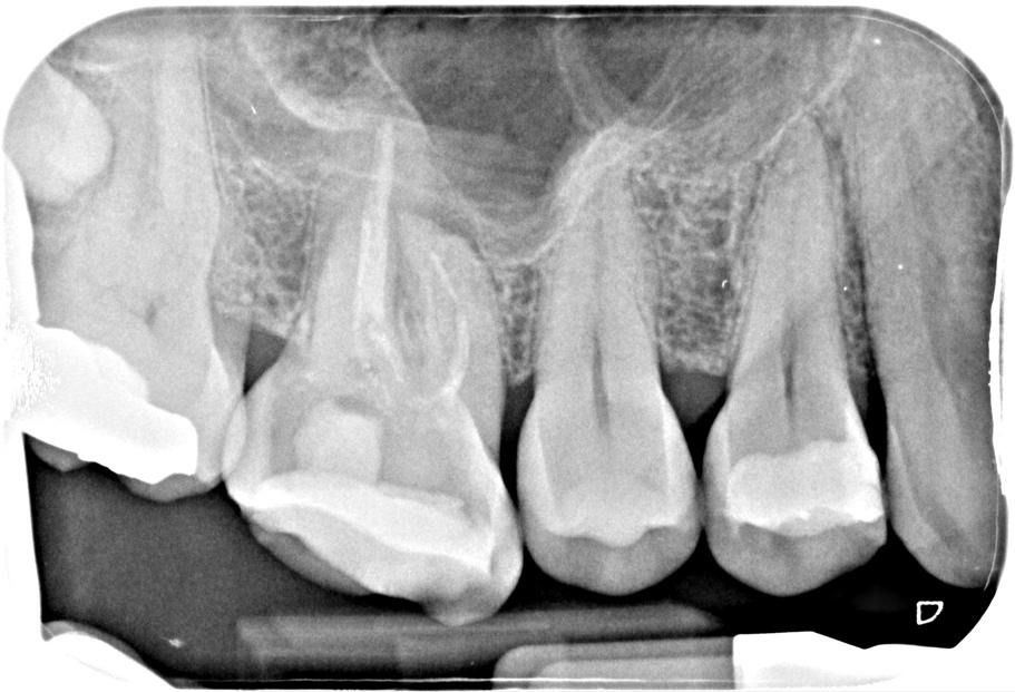 A close-up of teethDescription automatically generated