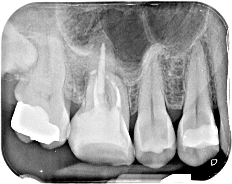 A close-up of teethDescription automatically generated
