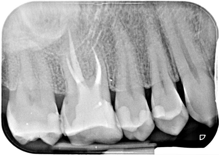 A close-up of teethDescription automatically generated