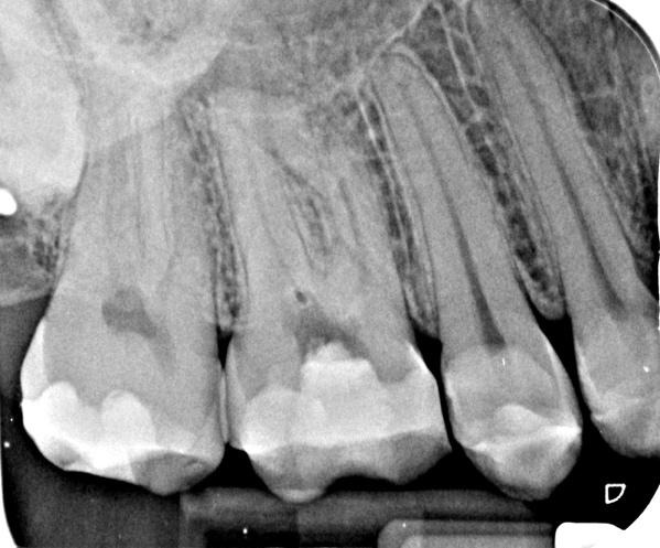 A close-up of teethDescription automatically generated