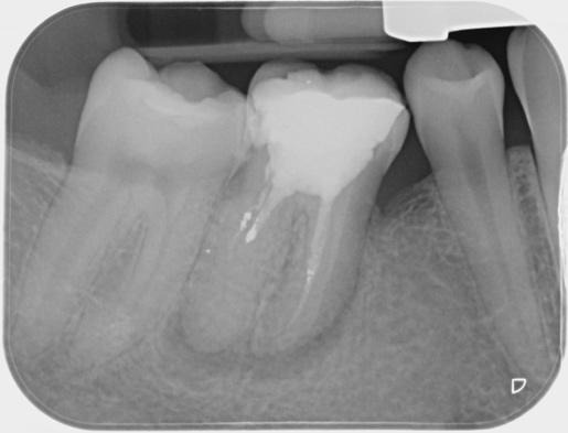 A close-up of teethDescription automatically generated