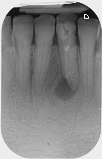 A close-up of teethDescription automatically generated