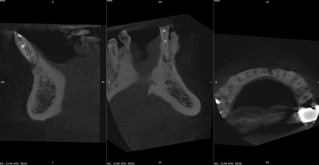 A close-up of a x-rayDescription automatically generated