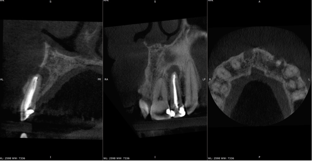 A close-up of a dental x-rayDescription automatically generated