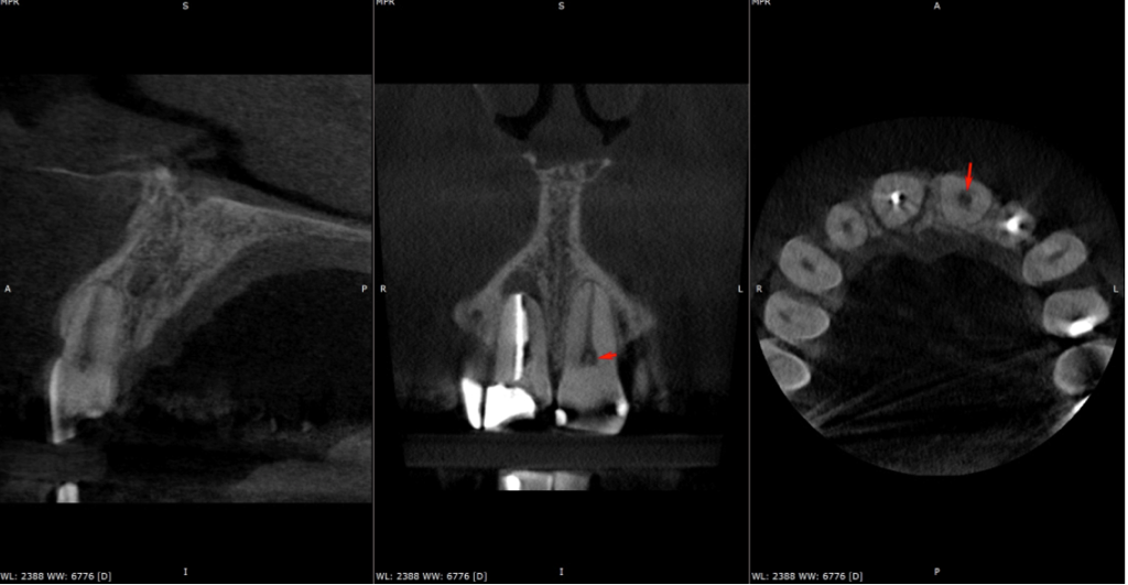 A close-up of a x-rayDescription automatically generated