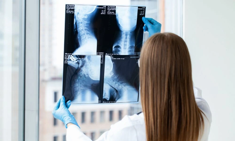 L'image montre une radiologue qui examine une radiographie. Elle tient la radiographie à la hauteur des yeux, probablement en utilisant la lumière de la fenêtre pour mieux observer les détails de l'image.