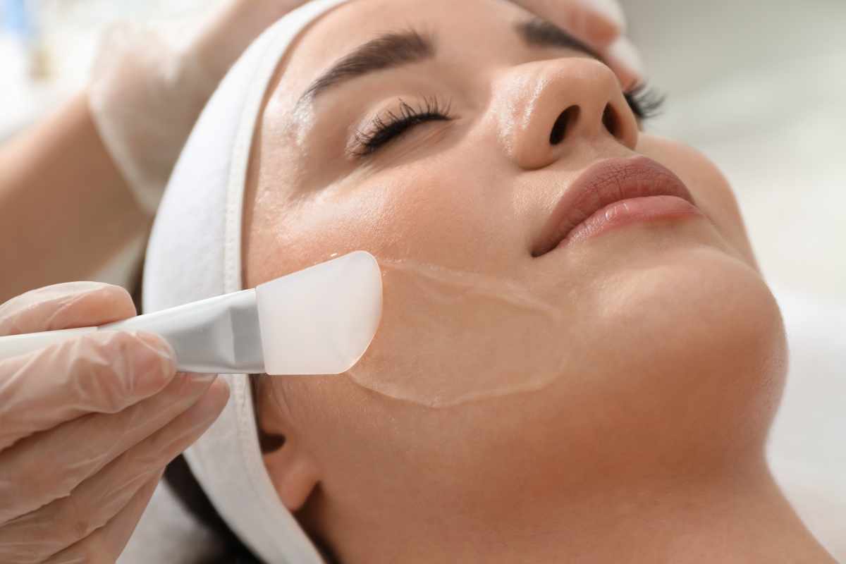 Chemical Peel