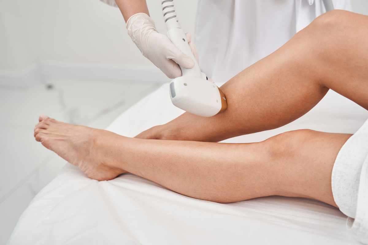 Laser hair removal